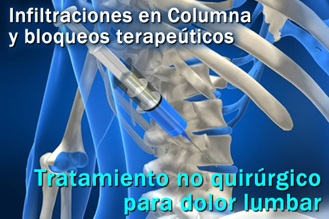 Tratamiento para dolor lumbar en Metepec y Toluca