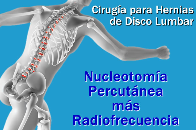Cirugía para hernia de disco en Toluca