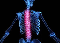 Cirugía de  columna vertebral en Toluca